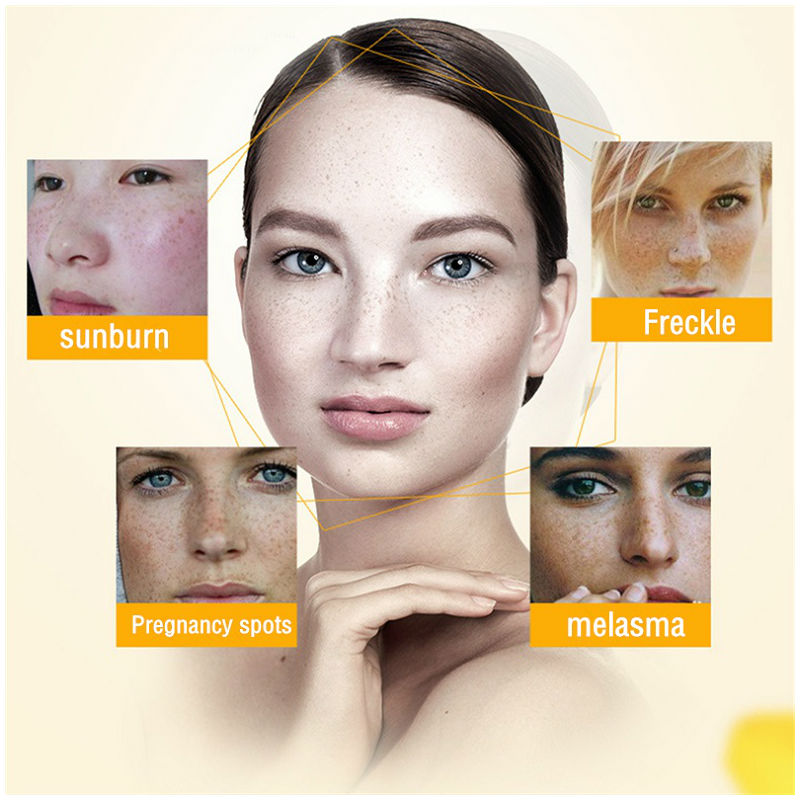 Dimollaure Whitening Freckle C - Retinol Cream avaliação e preço